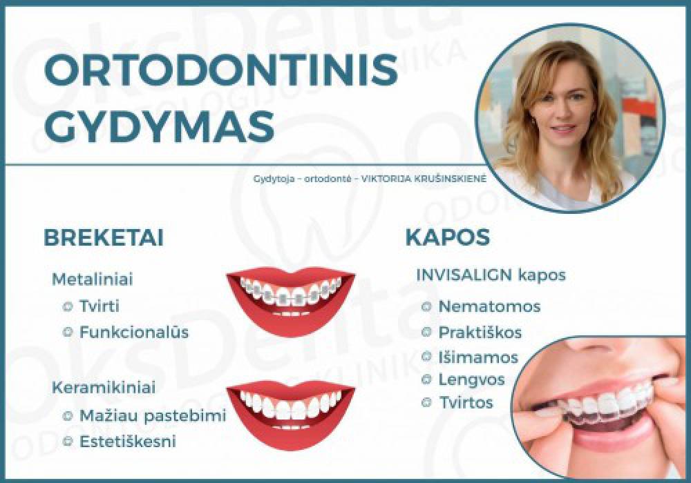 Ortodontinis gydymas. Dantų tiesinimo būdai ir svarba.