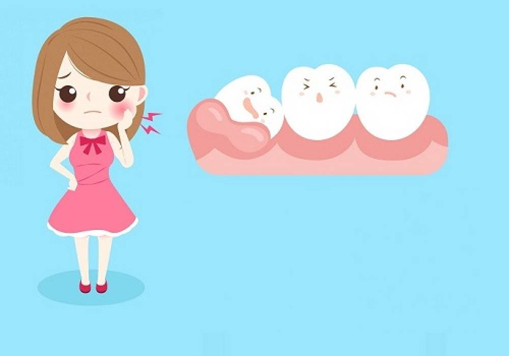 Protiniai dantys. Kada protinius dantis reikia šalinti?